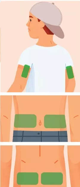Dexcom ONE+ kids
