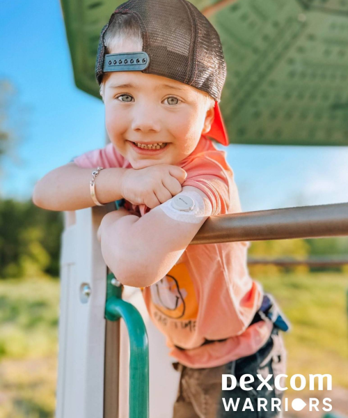 Dexcom ONE+ Dexcom ONE+