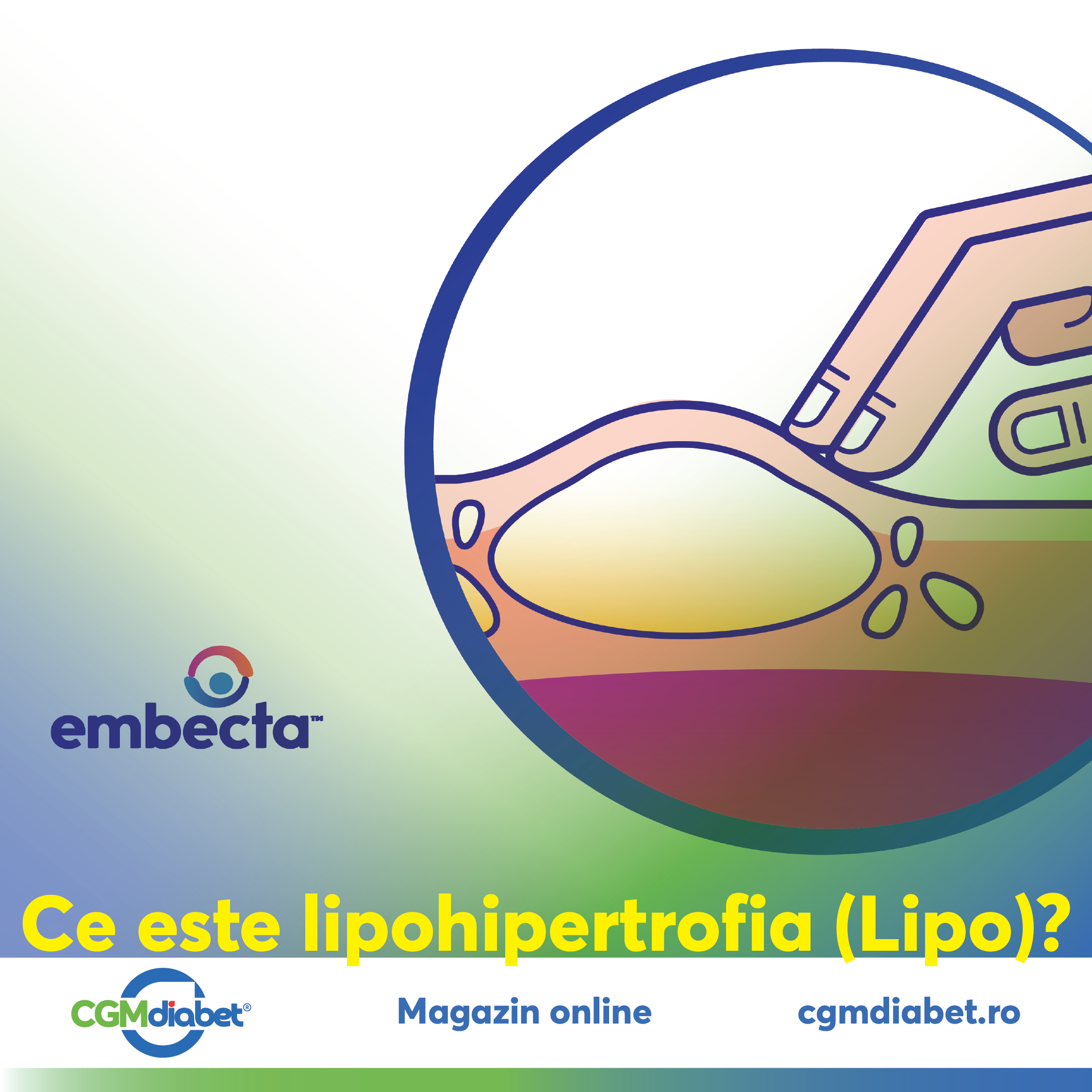 CGMDiabetRomania, diabet, viatacudiabet, EducatieDiabet, CGM, MonitorizareGlucoza, Sanatate, ManagementDiabet, DiabetTip1, DiabetTip2, Lipohipertrofie, Lipo, Diabet, Insulina, ControlGlicemic, SanatateaPielii, InjectareCorecta, EducatieDiabet, RotireLocuriInjectare, DiabetTip1, StilDeViataSanatos