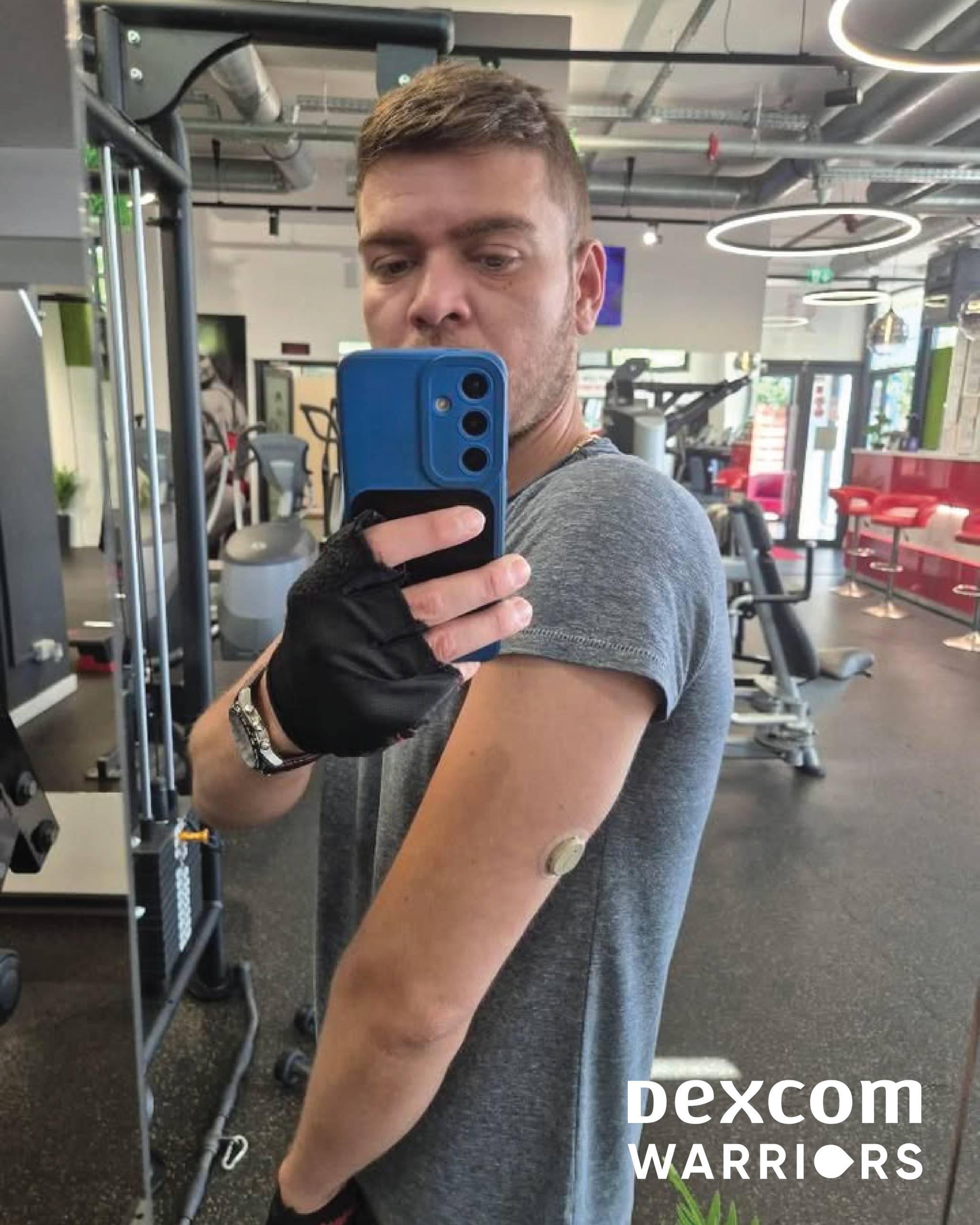 dexcom warriors